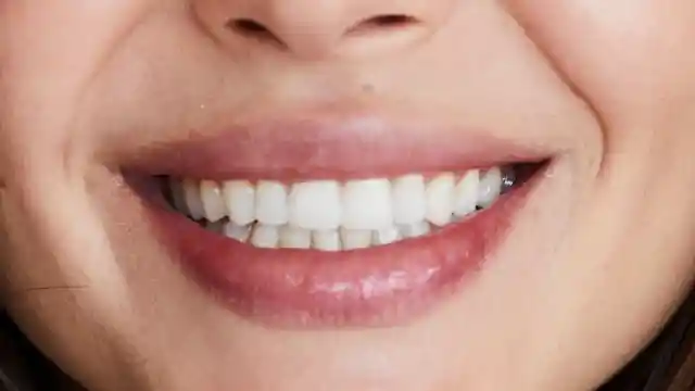 Surpresa