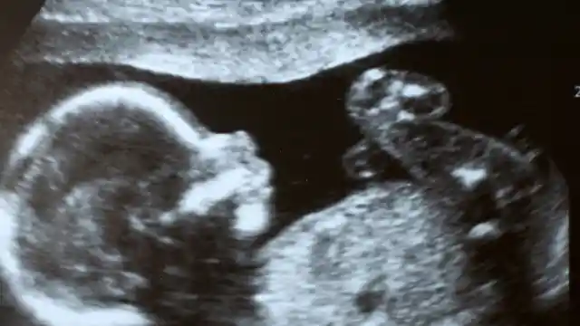 An Ultrasound?