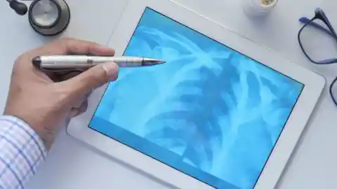 X-Ray