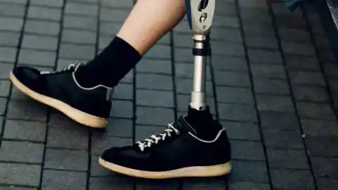 Prosthetic Leg